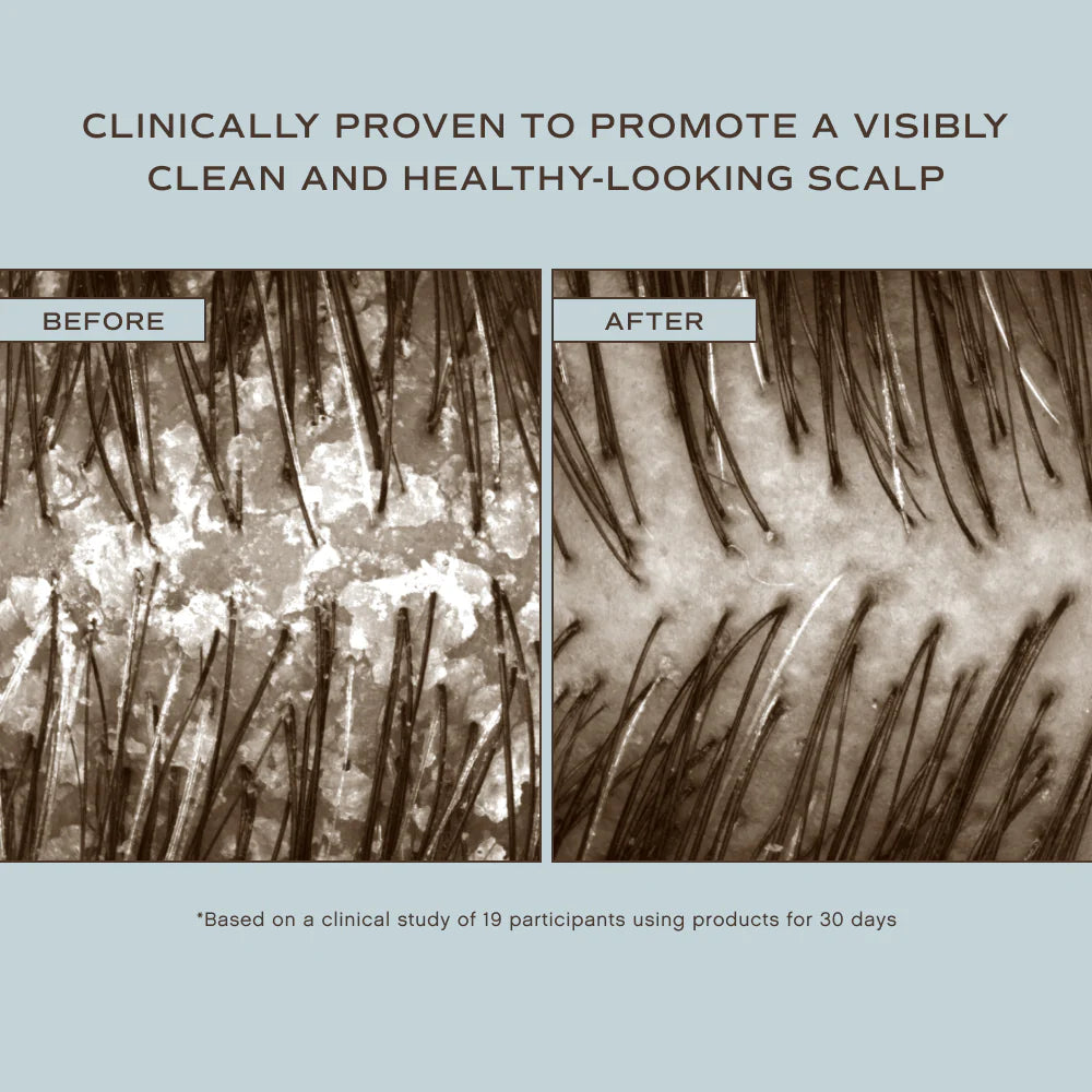 Hair Renew Scalp Soothing Conditioner